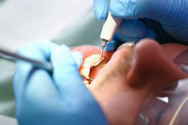 Best Walk-In Emergency Dentist in Crystal Lawns, IL