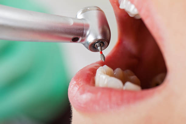Best Emergency Dental Surgery in Crystal Lawns, IL